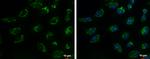 TIM17 Polyclonal Antibody