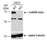 CaMKK beta Antibody in Western Blot (WB)