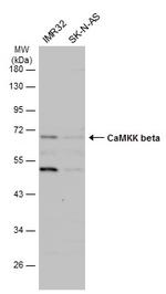 CaMKK beta Antibody in Western Blot (WB)