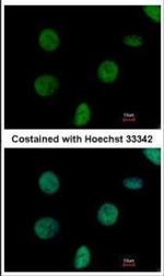 C1orf57 Polyclonal Antibody