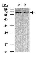 XYLB Polyclonal Antibody