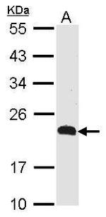 CMTM5 Polyclonal Antibody