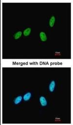 RED Polyclonal Antibody