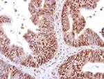RED Antibody in Immunohistochemistry (Paraffin) (IHC (P))