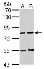 RED Antibody in Western Blot (WB)