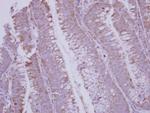 BMP-10 Polyclonal Antibody