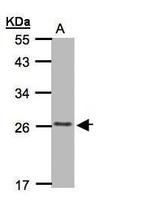 CMTM5 Polyclonal Antibody