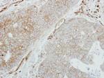 HLA-DMB Polyclonal Antibody