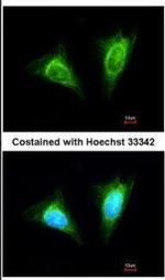 NKG2A Polyclonal Antibody