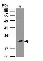 KLRC4 Polyclonal Antibody