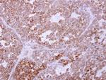 TRAM1 Antibody in Immunohistochemistry (Paraffin) (IHC (P))