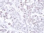 CAMK1D Antibody in Immunohistochemistry (Paraffin) (IHC (P))