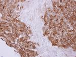 Profilin 2 Polyclonal Antibody