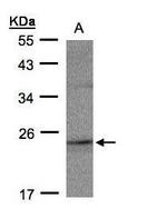 RAP2C Antibody in Western Blot (WB)