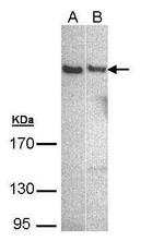 PLCH1 Isoform B Polyclonal Antibody