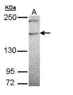 PLCH1 Isoform B Polyclonal Antibody
