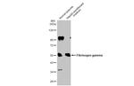 Fibrinogen gamma Antibody in Western Blot (WB)