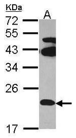 FAM18B Polyclonal Antibody