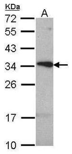 TSPAN1 Antibody in Western Blot (WB)
