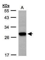 TSPAN1 Antibody in Western Blot (WB)