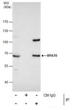 RPA70 Antibody in Immunoprecipitation (IP)