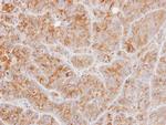 alpha Tubulin Antibody in Immunohistochemistry (Paraffin) (IHC (P))
