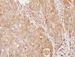 PDE9A Polyclonal Antibody