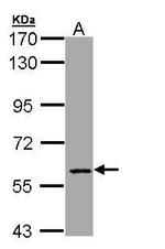 MTGR1 Antibody in Western Blot (WB)