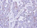 Desmocollin 2 Polyclonal Antibody