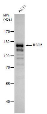 Desmocollin 2 Antibody in Western Blot (WB)