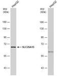 SLC25A13 Antibody in Western Blot (WB)