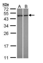 NNT1 Antibody in Western Blot (WB)