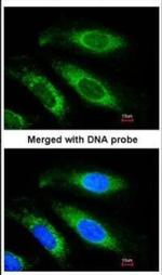 ETFB Polyclonal Antibody