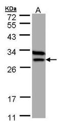 ETFB Antibody in Western Blot (WB)