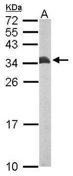 ETFB Antibody in Western Blot (WB)