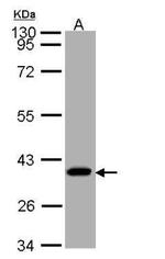 SUCLG1 Antibody in Western Blot (WB)