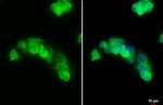 Arginase 1 Antibody in Immunocytochemistry (ICC/IF)