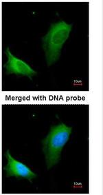 Arginase 1 Antibody in Immunocytochemistry (ICC/IF)