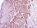 Arginase 1 Antibody in Immunohistochemistry (IHC)