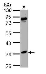 Arginase 1 Antibody in Western Blot (WB)