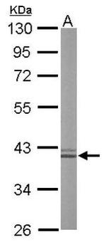 Arginase 1 Antibody in Western Blot (WB)