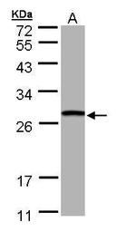 GSTT1 Antibody in Western Blot (WB)