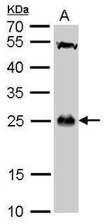 GSTT1 Antibody in Western Blot (WB)