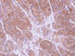 TPM2 Polyclonal Antibody