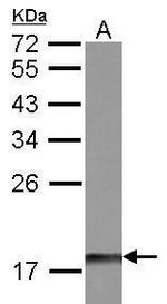 DUSP26 Antibody in Western Blot (WB)
