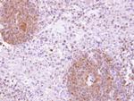 MAP4K5 Antibody in Immunohistochemistry (Paraffin) (IHC (P))