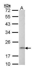 AP1S2 Polyclonal Antibody