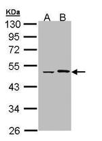 EPHX1 Antibody in Western Blot (WB)