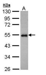 CCDC83 Antibody in Western Blot (WB)