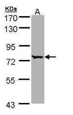 BBS10 Antibody in Western Blot (WB)